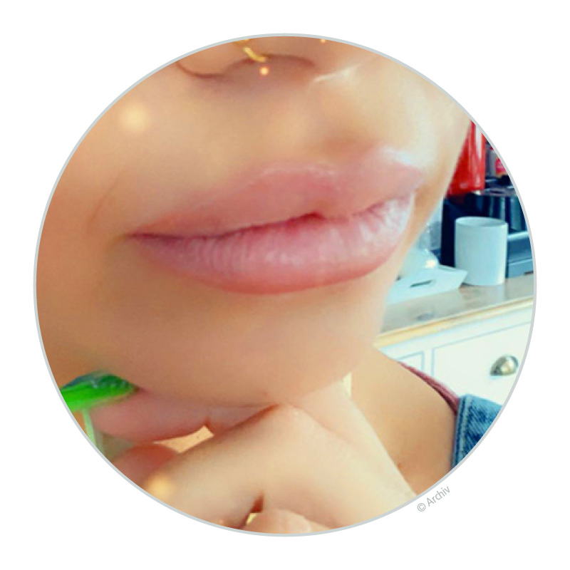 Lippenbehandlung_rund_600_RZ