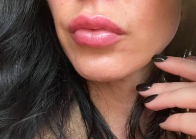 Lippenkorrektur