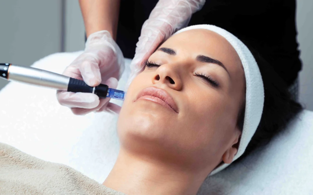 Micro Needle Therapie